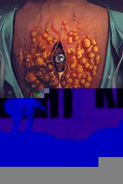 فيلم Cyst اونلاين مترجم